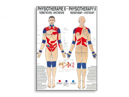 Thermotherapie fysiotherapie-poster