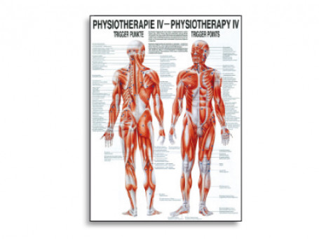 Triggerpoints fysiotherapie-poster