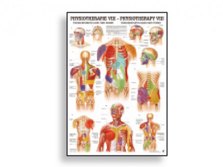 Triggerpoints Hoofd & Romp fysiotherapie-poster