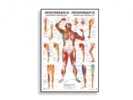 Triggerpoints Armen & Benen fysiotherapie-poster