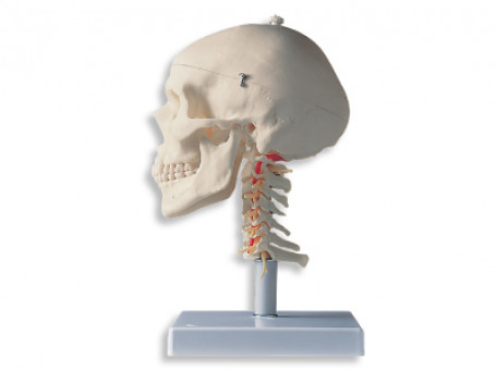 Schedel op halswervelkolom, 4-delig
